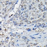 Immunohistochemistry - Anti-RanGAP1 Antibody (A91429) - Antibodies.com