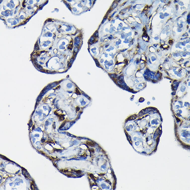 Immunohistochemistry - Anti-RanGAP1 Antibody (A91429) - Antibodies.com