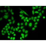 Immunofluorescence - Anti-RanGAP1 Antibody (A91429) - Antibodies.com