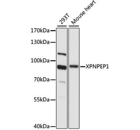 Western Blot - Anti-XPNPEP1 Antibody (A91430) - Antibodies.com