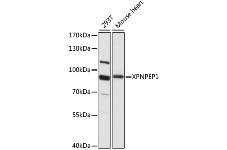 Western Blot - Anti-XPNPEP1 Antibody (A91430) - Antibodies.com