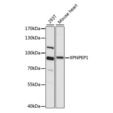 Western Blot - Anti-XPNPEP1 Antibody (A91430) - Antibodies.com