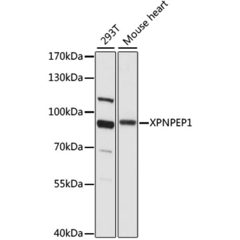 Western Blot - Anti-XPNPEP1 Antibody (A91430) - Antibodies.com