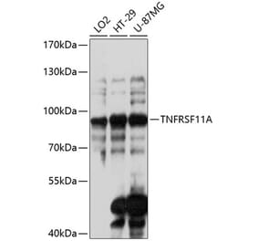 Western Blot - Anti-RANK Antibody (A91431) - Antibodies.com