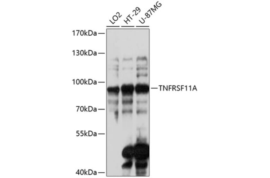 Western Blot - Anti-RANK Antibody (A91431) - Antibodies.com