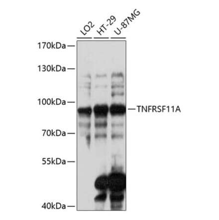 Western Blot - Anti-RANK Antibody (A91431) - Antibodies.com