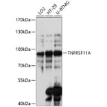 Western Blot - Anti-RANK Antibody (A91431) - Antibodies.com