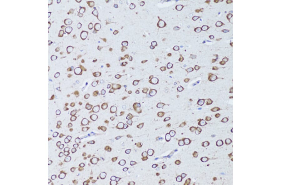 Immunohistochemistry - Anti-RANK Antibody (A91431) - Antibodies.com
