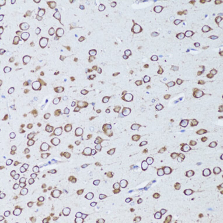 Immunohistochemistry - Anti-RANK Antibody (A91431) - Antibodies.com