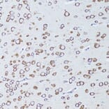 Immunohistochemistry - Anti-RANK Antibody (A91431) - Antibodies.com