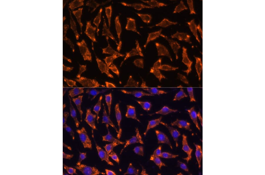 Immunofluorescence - Anti-RANK Antibody (A91431) - Antibodies.com