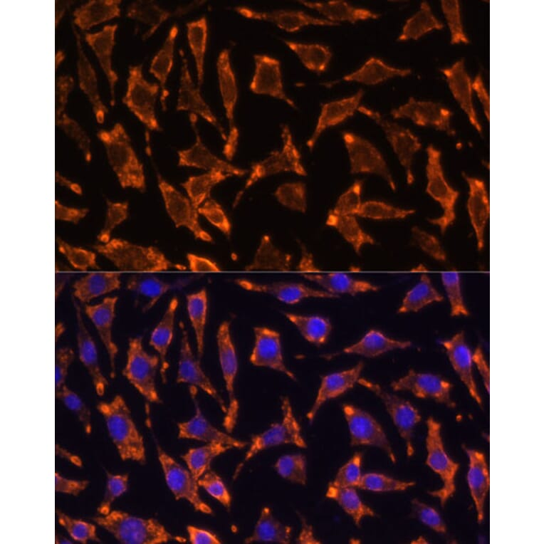 Immunofluorescence - Anti-RANK Antibody (A91431) - Antibodies.com