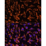 Immunofluorescence - Anti-RANK Antibody (A91431) - Antibodies.com