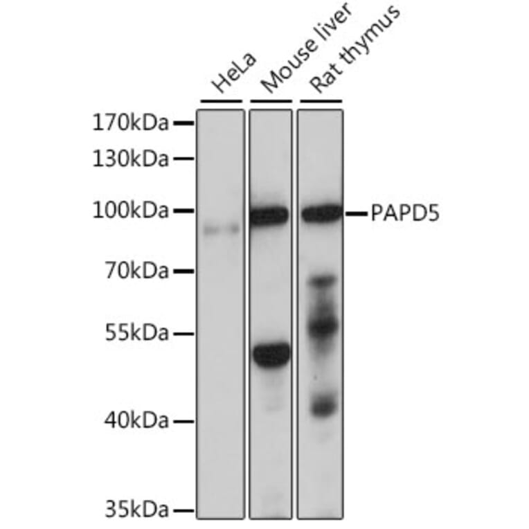 Western Blot - Anti-PAPD5 Antibody (A91432) - Antibodies.com