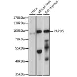 Western Blot - Anti-PAPD5 Antibody (A91432) - Antibodies.com
