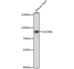 Western Blot - Anti-CACNB2 Antibody (A91433) - Antibodies.com
