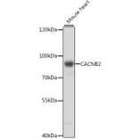 Western Blot - Anti-CACNB2 Antibody (A91433) - Antibodies.com
