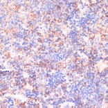 Immunohistochemistry - Anti-CACNB2 Antibody (A91433) - Antibodies.com