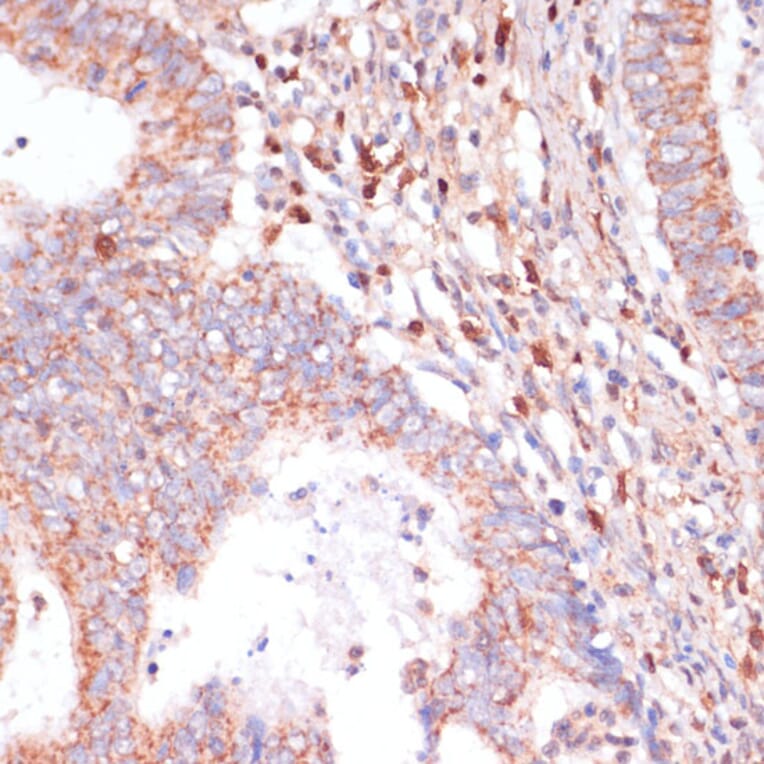 Immunohistochemistry - Anti-CACNB2 Antibody (A91433) - Antibodies.com