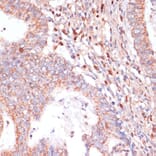 Immunohistochemistry - Anti-CACNB2 Antibody (A91433) - Antibodies.com
