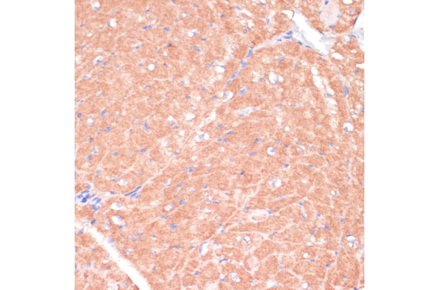 Immunohistochemistry - Anti-CACNB2 Antibody (A91433) - Antibodies.com