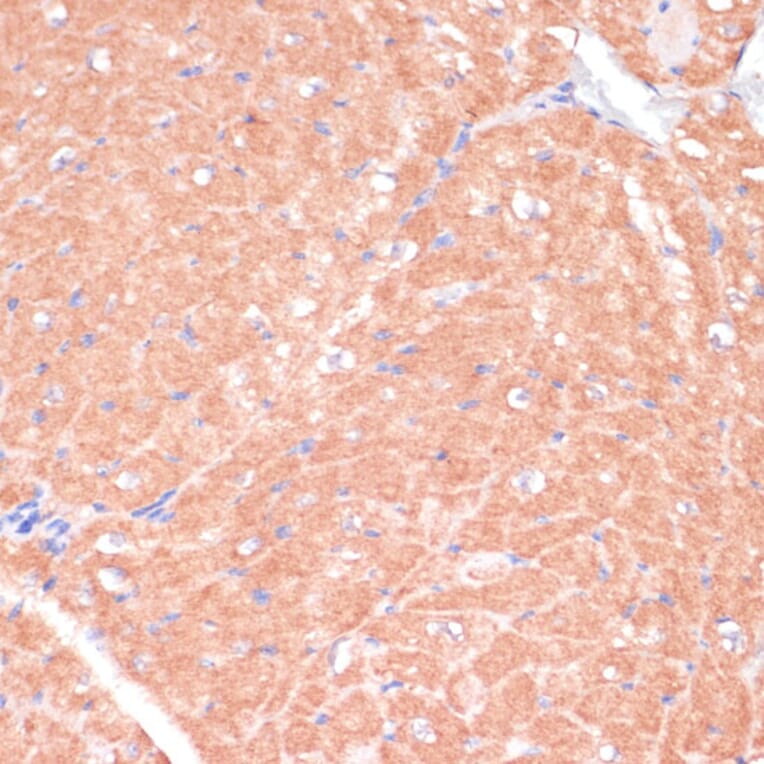 Immunohistochemistry - Anti-CACNB2 Antibody (A91433) - Antibodies.com
