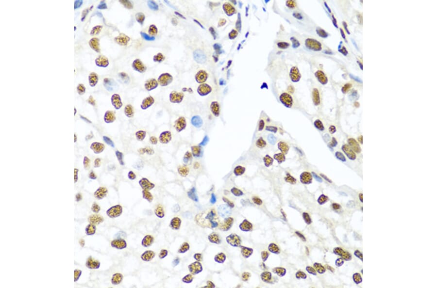 Immunohistochemistry - Anti-Ku80 Antibody (A91434) - Antibodies.com
