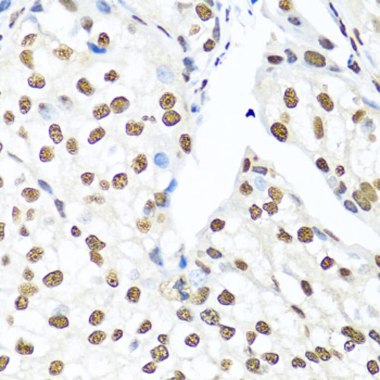 Immunohistochemistry - Anti-Ku80 Antibody (A91434) - Antibodies.com