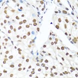 Immunohistochemistry - Anti-Ku80 Antibody (A91434) - Antibodies.com