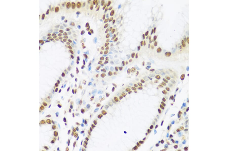 Immunohistochemistry - Anti-Ku80 Antibody (A91434) - Antibodies.com