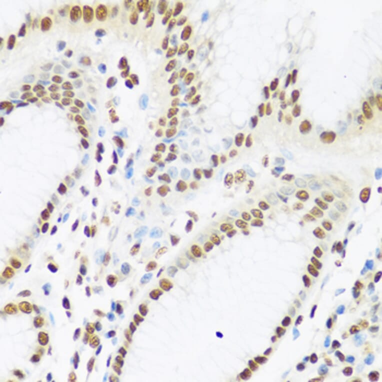 Immunohistochemistry - Anti-Ku80 Antibody (A91434) - Antibodies.com