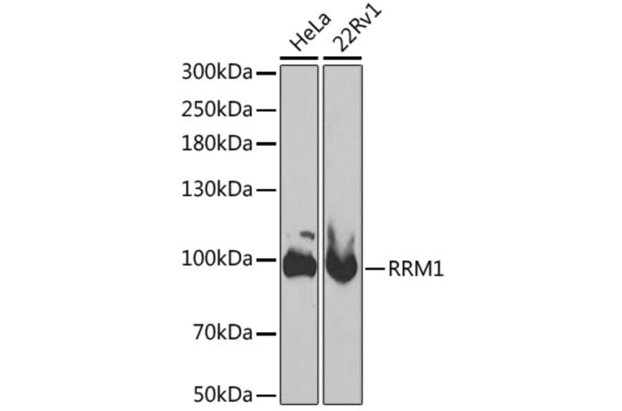 Western Blot - Anti-RRM1 Antibody (A13656) - Antibodies.com
