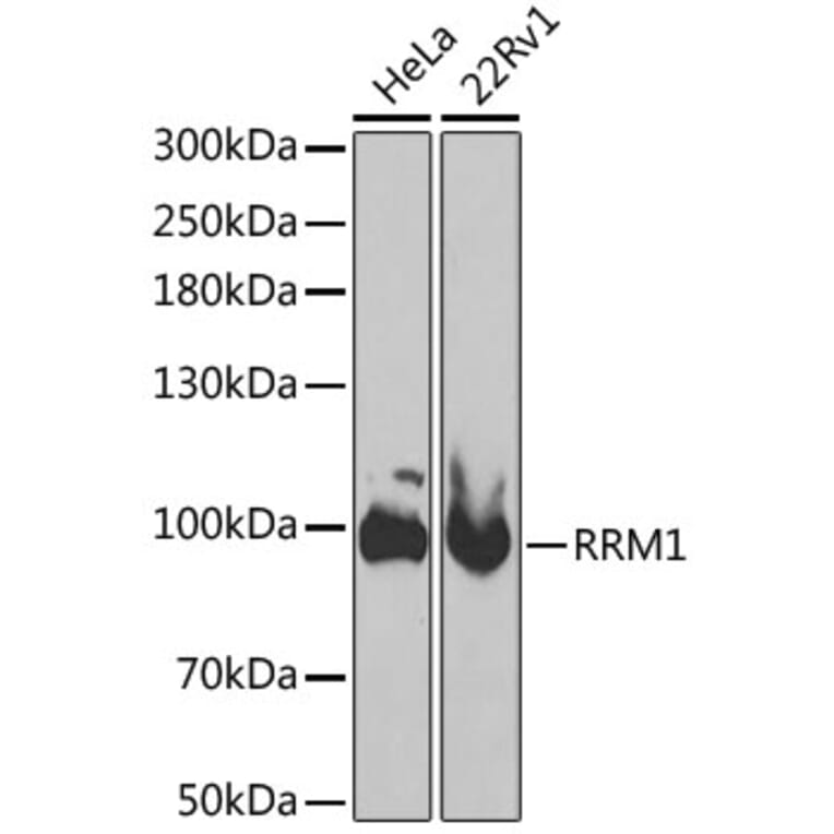 Western Blot - Anti-RRM1 Antibody (A13656) - Antibodies.com