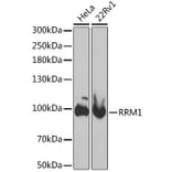 Western Blot - Anti-RRM1 Antibody (A13656) - Antibodies.com