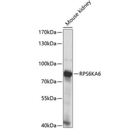Western Blot - Anti-RSK4 Antibody (A91436) - Antibodies.com