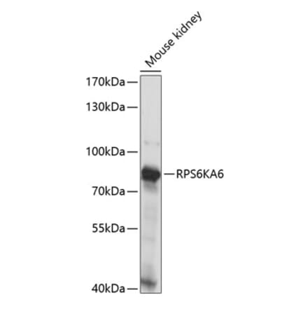 Western Blot - Anti-RSK4 Antibody (A91436) - Antibodies.com