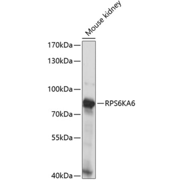 Western Blot - Anti-RSK4 Antibody (A91436) - Antibodies.com