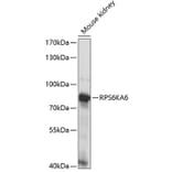 Western Blot - Anti-RSK4 Antibody (A91436) - Antibodies.com