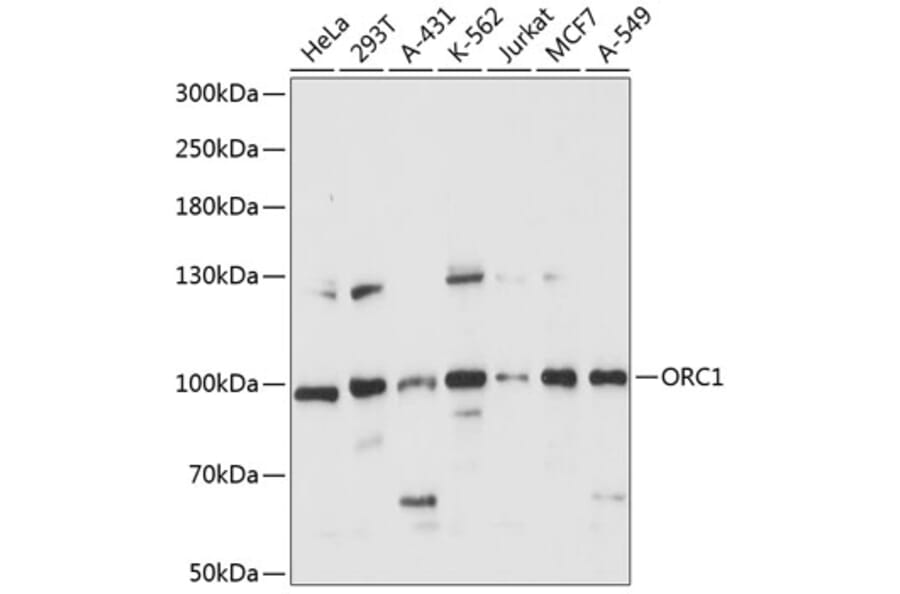 Western Blot - Anti-ORC1 Antibody (A91437) - Antibodies.com