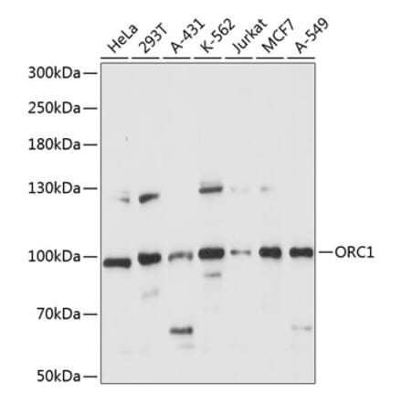 Western Blot - Anti-ORC1 Antibody (A91437) - Antibodies.com