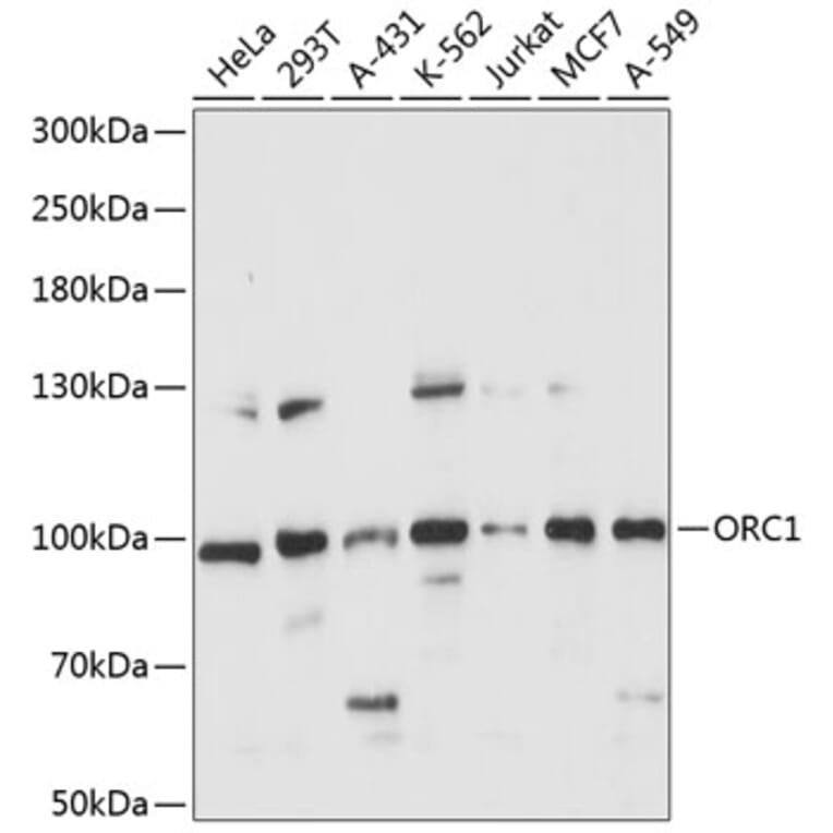 Western Blot - Anti-ORC1 Antibody (A91437) - Antibodies.com