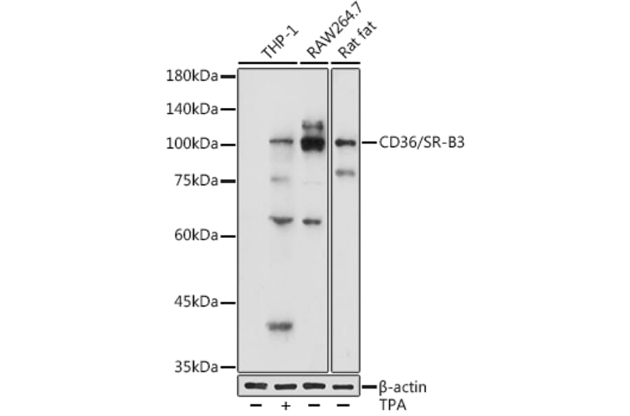 Western Blot - Anti-CD36 Antibody (A91438) - Antibodies.com