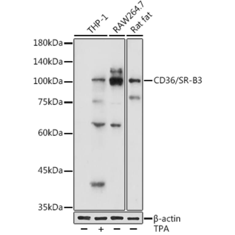 Western Blot - Anti-CD36 Antibody (A91438) - Antibodies.com