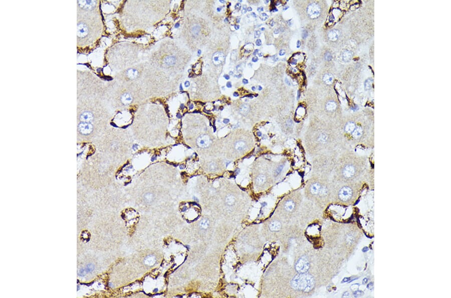 Immunohistochemistry - Anti-CD36 Antibody (A91438) - Antibodies.com