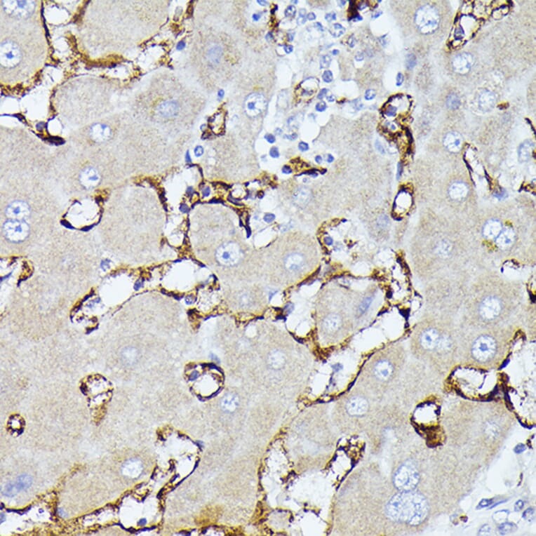 Immunohistochemistry - Anti-CD36 Antibody (A91438) - Antibodies.com