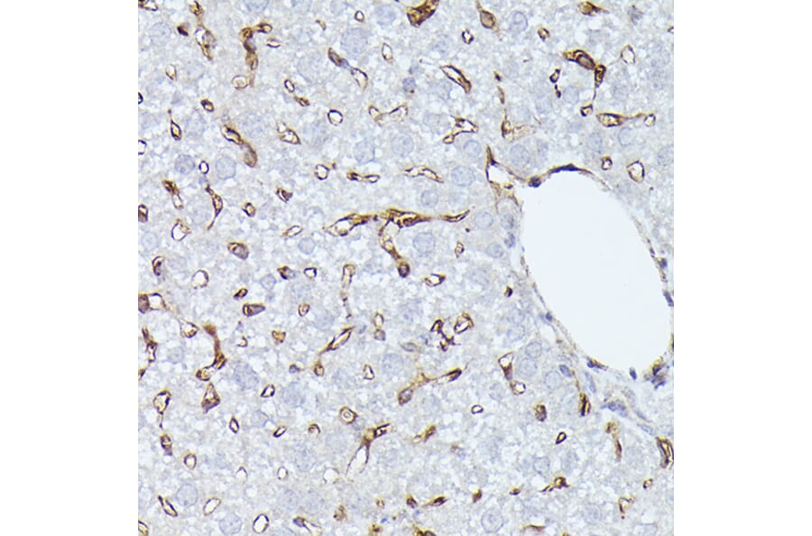 Immunohistochemistry - Anti-CD36 Antibody (A91438) - Antibodies.com