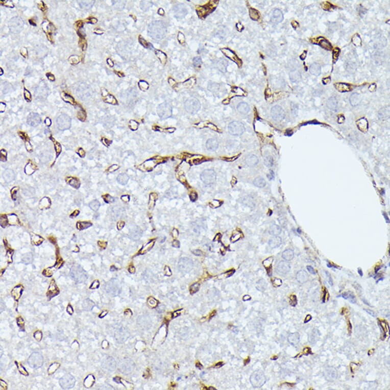 Immunohistochemistry - Anti-CD36 Antibody (A91438) - Antibodies.com