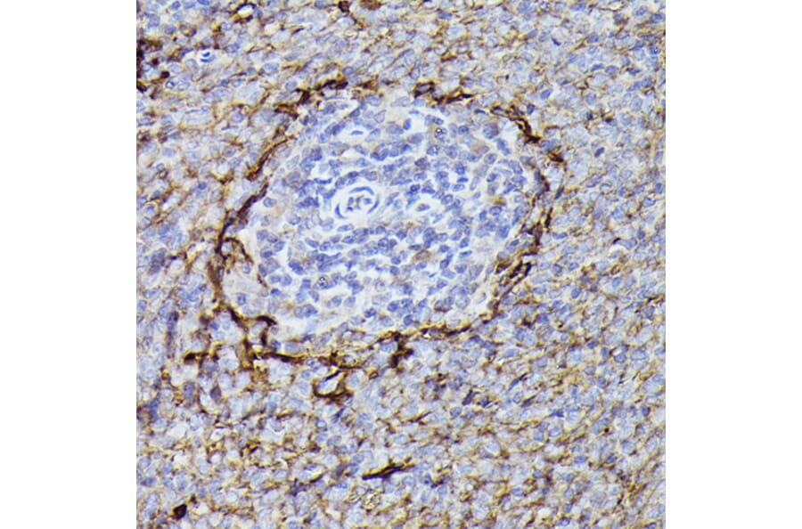 Immunohistochemistry - Anti-CD36 Antibody (A91438) - Antibodies.com