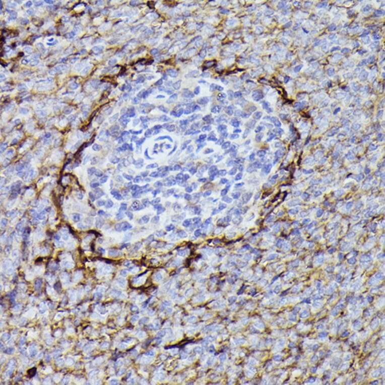 Immunohistochemistry - Anti-CD36 Antibody (A91438) - Antibodies.com