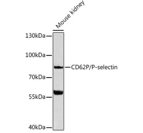 Western Blot - Anti-P-Selectin Antibody (A91439) - Antibodies.com